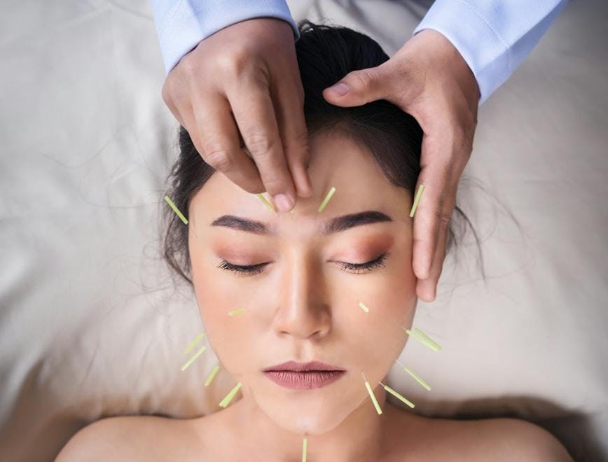 Frau mit Akupunkturnadeln im Gesicht